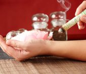 Moxibustion Therapy